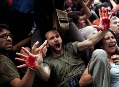 A demonstrator shows his hands covered with the blood of another protester as police try to remove them during clashes in Barcelona today.