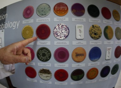A lab specialist points out different examples of Escherichia coli bacterial growth.