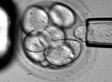 A single cell is removed from a human embryo to be used in generating embryonic stem cells for scientific research.