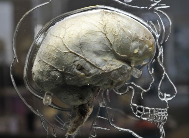 A real human brain suspended in liquid with a to-scale skeleton, central nervous system and human silhouette carved into acrylic, inside the @Bristol science attraction