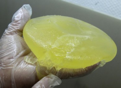 10 January 2012: A faulty PIP implant removed by a surgeon in Nice, France.