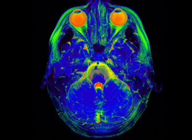 Scan of a brain