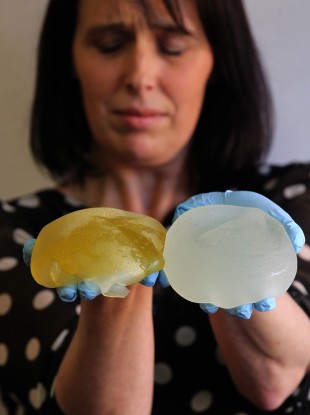 PiP implant victim Jenny Brown poses with her ruptured implants after having them removed a few months ago.