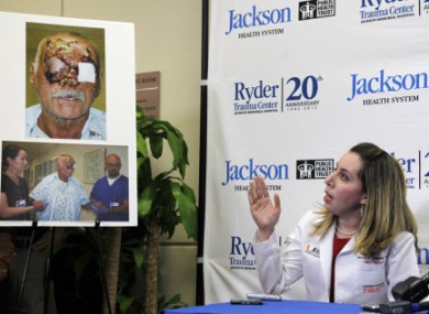 Plastic surgeon Dr Wrood Kassira gestures to images of Ronald Poppo during a press conference on his condition.