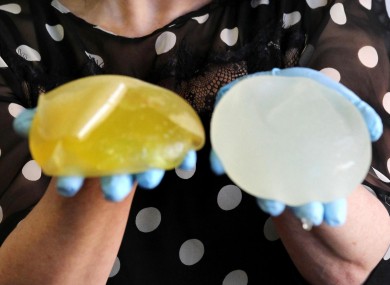 Scottish PiP implant victim posing with her ruptured PiP implants after having them removed.