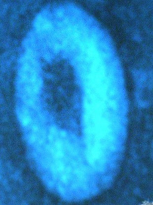 A picture of the SARS coronavirus