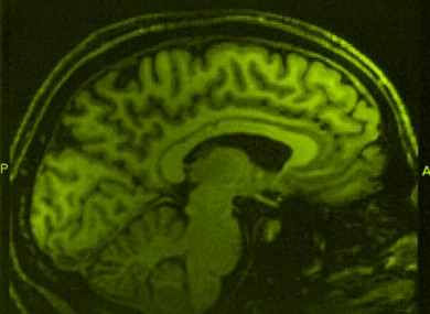 A brain scan