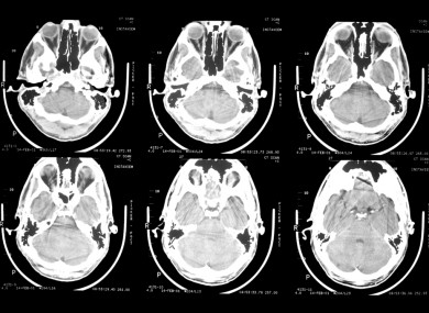 Brain scans.