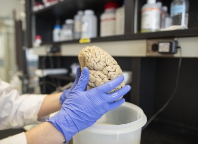 A researcher holds a human brain in a laboratory at Northwestern University's cognitive neurology and Alzheimer's disease center in Chicago