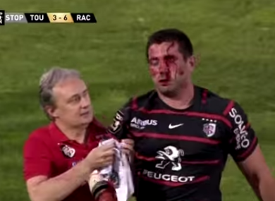 Florian Fritz was allowed to return to the field after being knocked out in a Top 14 barrages match.