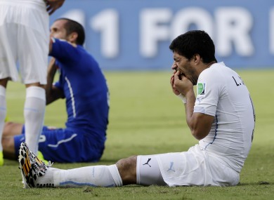 Luis Suarez holds his teeth after clashing with Giogio Chiellini of Italy.