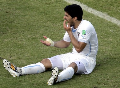 Suarez moments after the infamous biting incident.