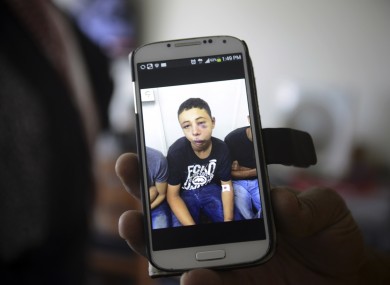 Suha Abu Khdeir, mother of 15-year-old Tariq Abu Khdeir, a US citizen, shows a mobile phone photo of Tariq taken in a hospital after he was beaten and arrested by the Israeli police