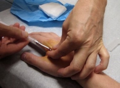 Human microchipping