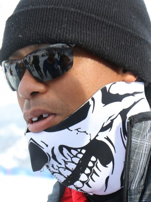 Tiger Woods says his tooth was knocked out by a cameraman.