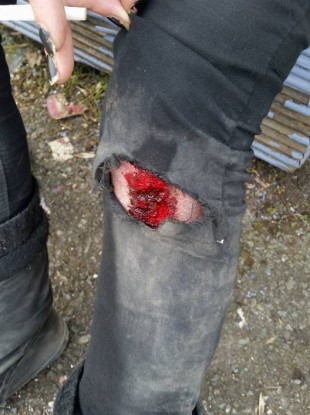 One of the women injured at today's protest.