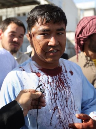An injured man in interviewed by journalists after an explosion struck a protest in Kabul.