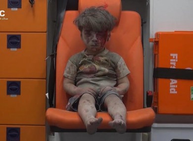 Five-year-old Omran Daqneesh sits in an ambulance after being pulled out or a building hit by an airstirke, in Aleppo.