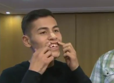Gutierrez shows his injuries.