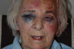 Reward offered after 'vicious' assault on pensioner in London 
