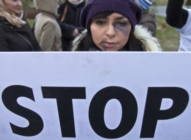 A young Romanian woman wearing makeup takes part in a protest in Bucharest last year.