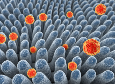 Hepatitis A viruses infecting intestine - 3D illustration.