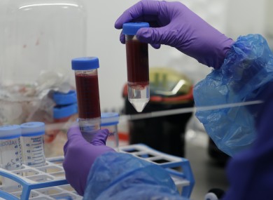 File photo. Blood samples from coronavirus patients are prepared for analysis.