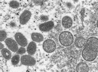 Monkeypox virus particles.