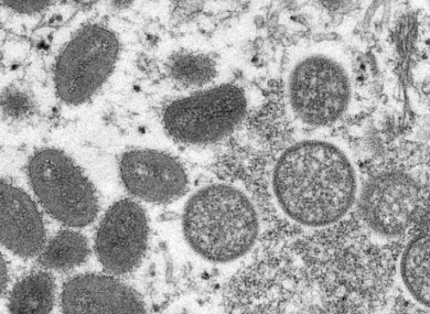 The monkeypox virus under a microscope