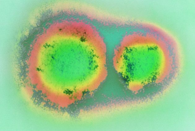 'Covid 2.0': Pandemic-era conspiracies return after the hantavirus outbreak on a cruise ship
