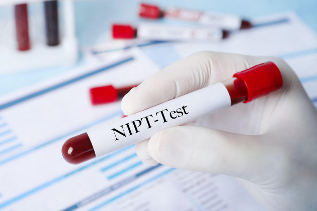 Still no agreement on making costly prenatal testing available through the public system